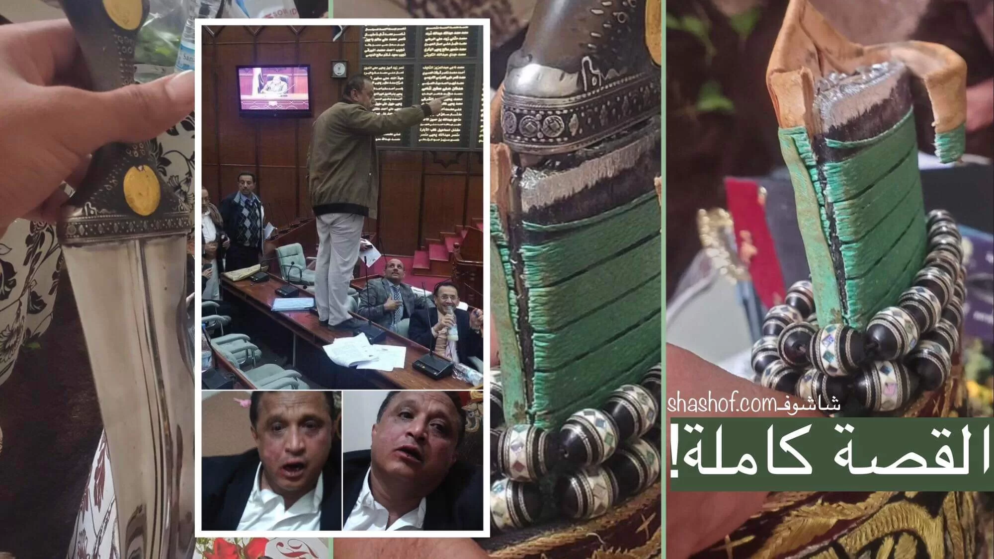 احمد سيف حاشد يروي قصة الصحفي مجلي الصمدي الذي تم الاعتداء عليه في صنعاء